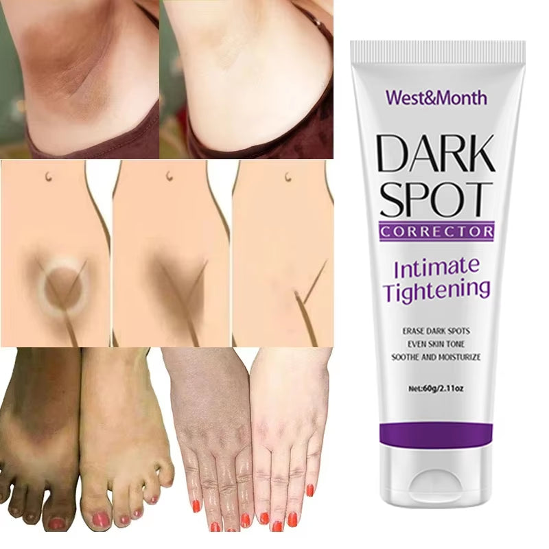 Nicotinamide Brightening Cream for Dark Skin Effective Lighten Thigh Inner Skincare Remove Melanin Private Parts Brighten Cream