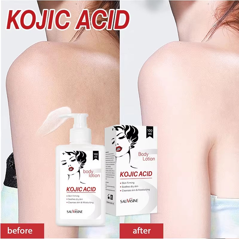 Kojic Acid Body Lotion Skin Brightening Even Skin Tone Bleaching Moisturizing Body Cream Nourishing Smoothing Skin Care