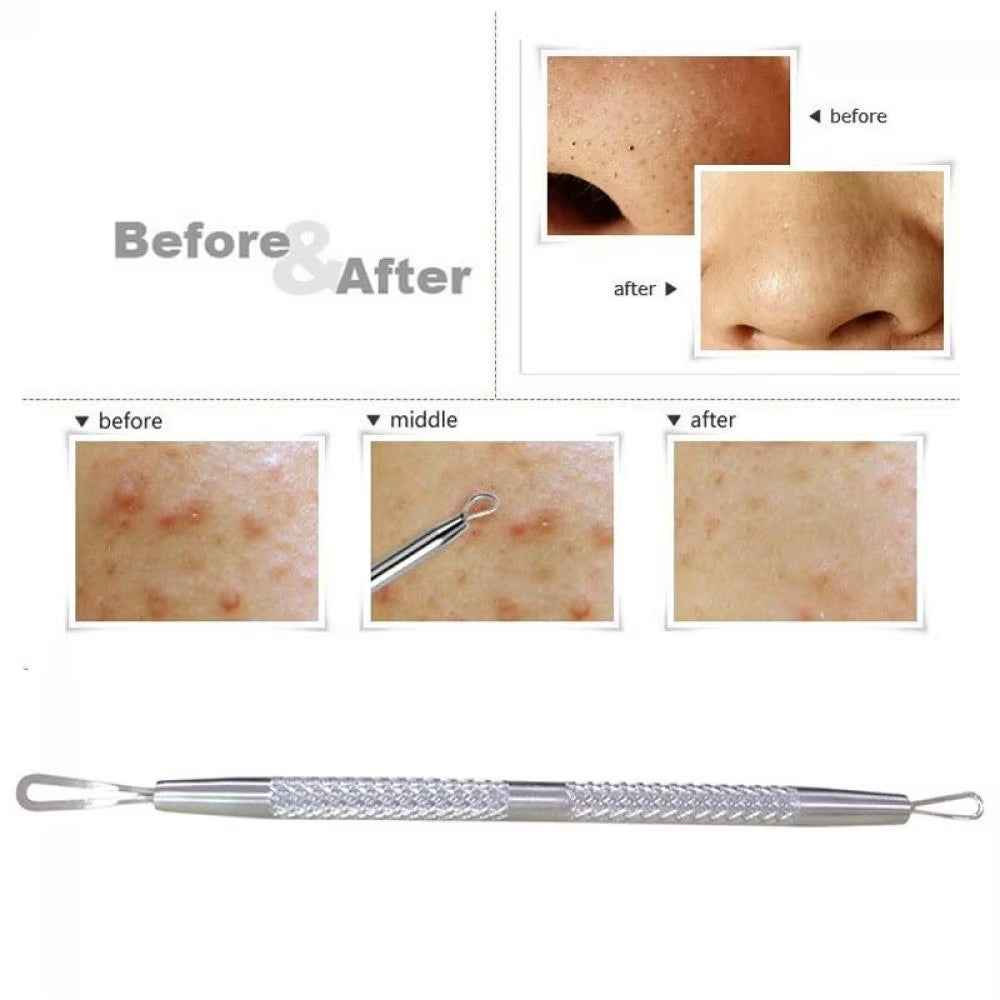 Professional Stainless Steel Blackhead Remover Tool Comedone Acne Pimple 2 Loop Needles Blemish Extractor Remover Skin Care Tool