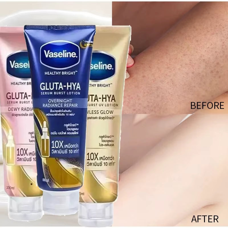 Vaseline Whitening Body Lotion Drying Moisturizing Cream Nicotinamide Long Acting Body Lotion Chicken Skin Removing Body Cream