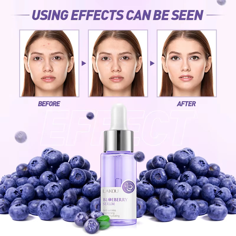 Blueberry Facial Serum Moisturing Skin Hydrating Repair Skin Improve Roughness Smoothing Hyaluronic Acid Skin Care