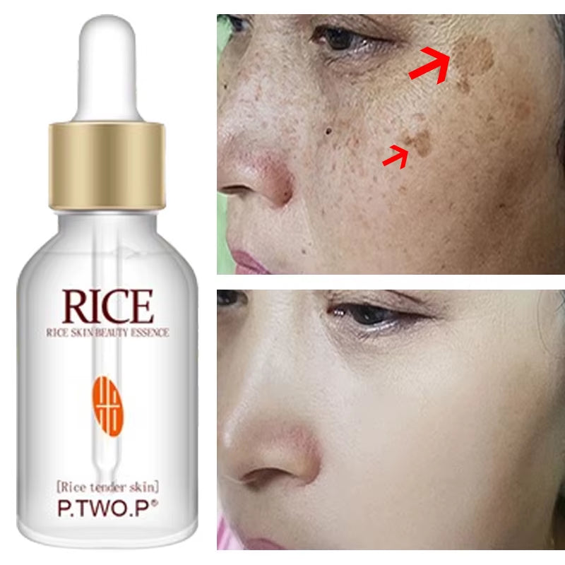 Brightening Serum for Face Korean Product Dark Spot Freckle Remover Lighten Acne Mark Whitening Improve Dullness Moisturize Skin