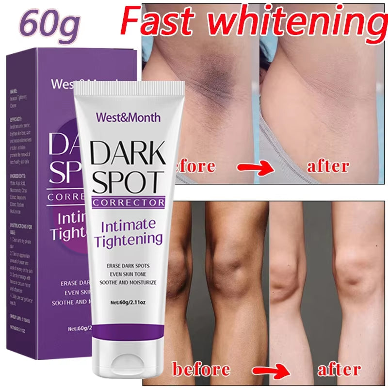 Nicotinamide Brightening Cream for Dark Skin Effective Lighten Thigh Inner Skincare Remove Melanin Private Parts Brighten Cream