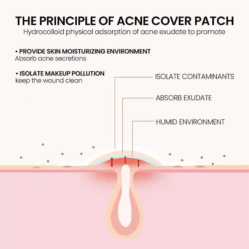 Repair Acne Patch Facial Skin Care Fade Blemishes Pimple Marks Closed Acne Blemishes Cover Acne Pimple Repair Patch