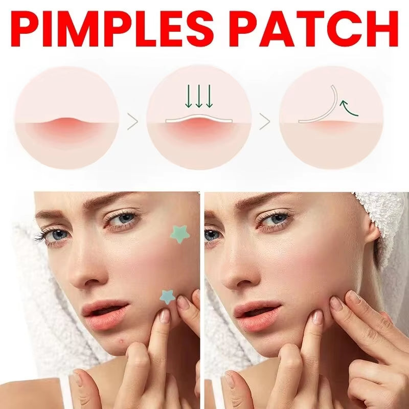 Repair Acne Patch Facial Skin Care Fade Blemishes Pimple Marks Closed Acne Blemishes Cover Acne Pimple Repair Patch